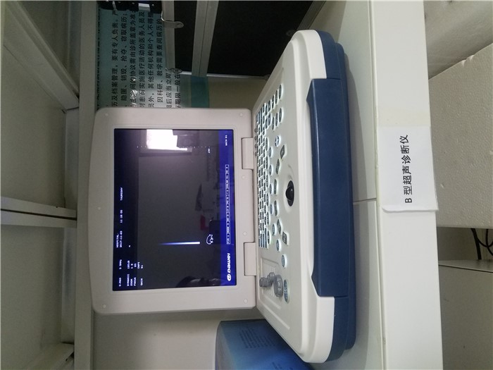 B型超声诊断仪